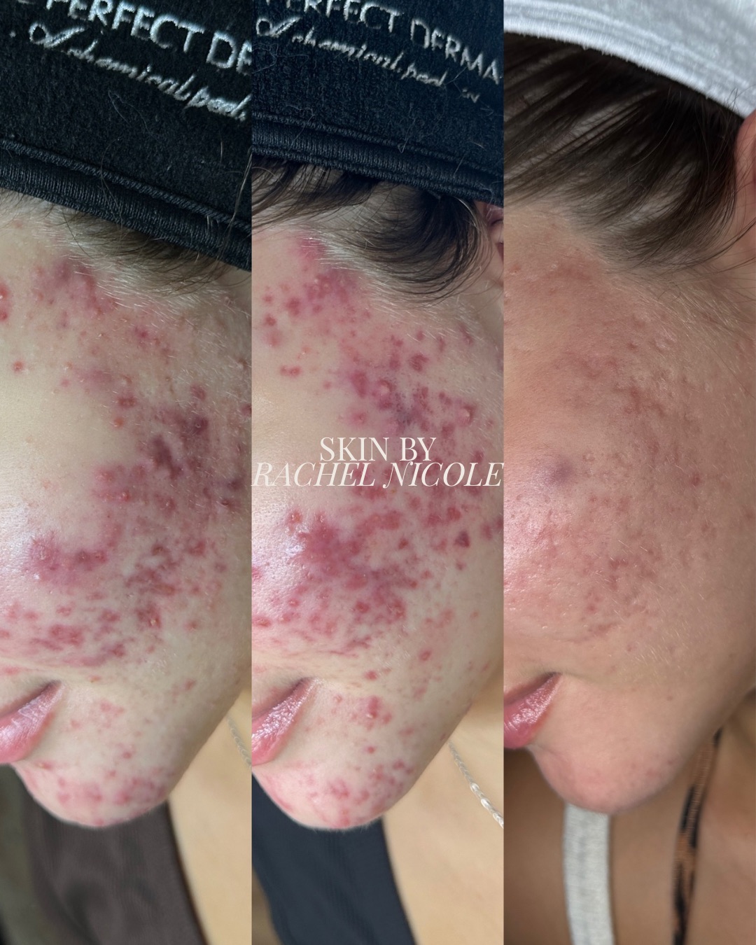 skin transformation