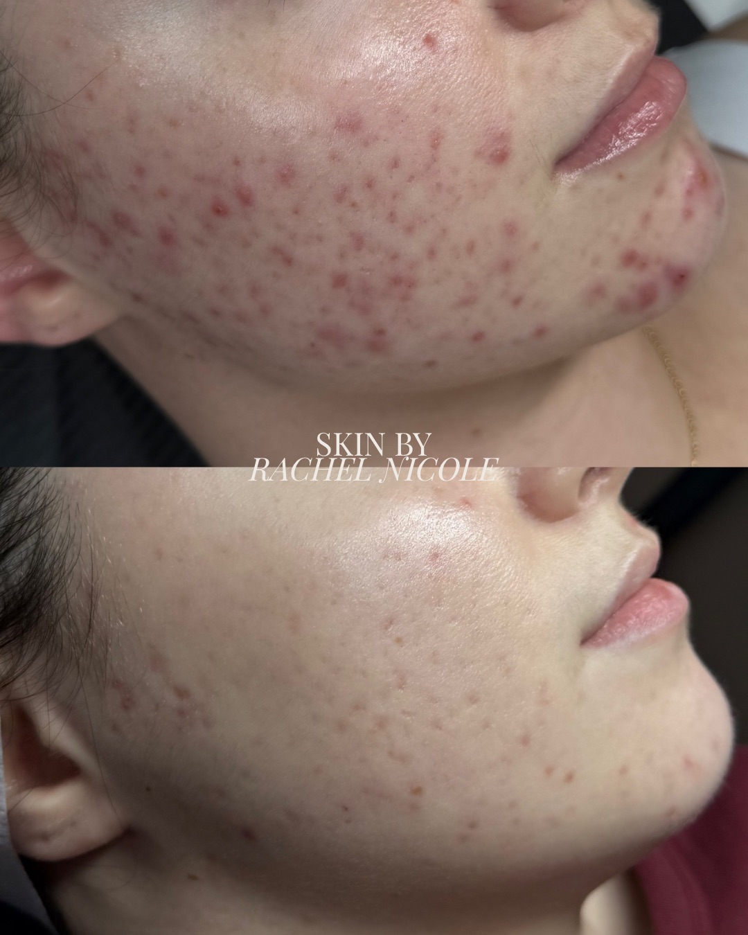 skin transformation