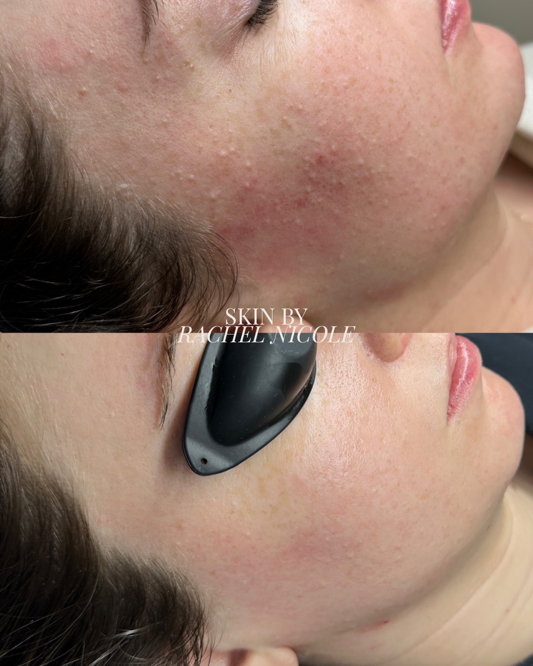skin transformation