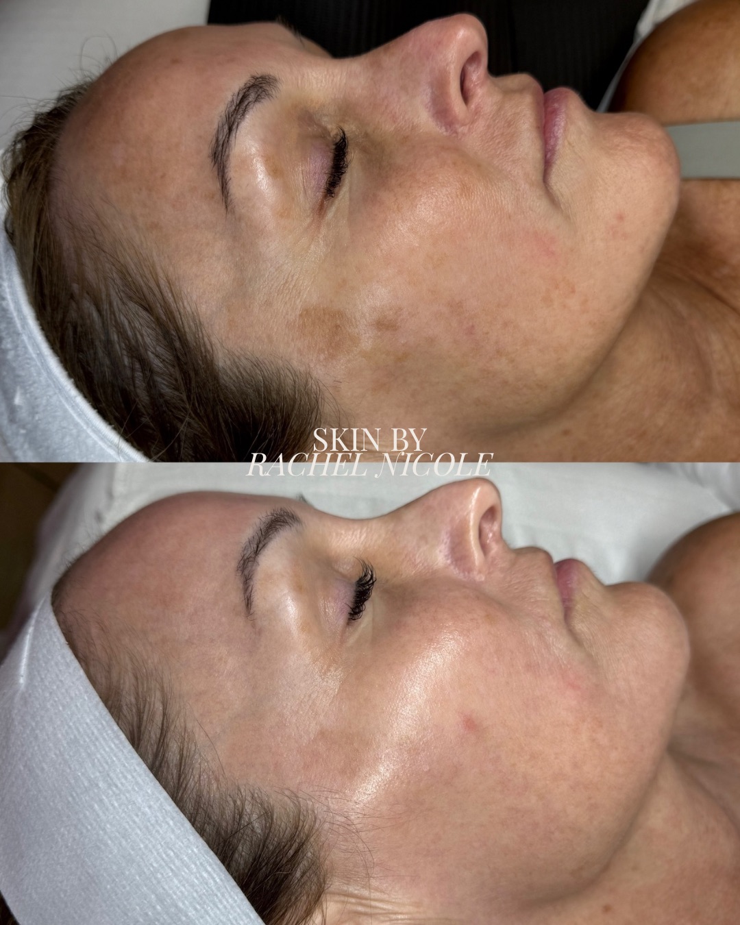 skin transformation