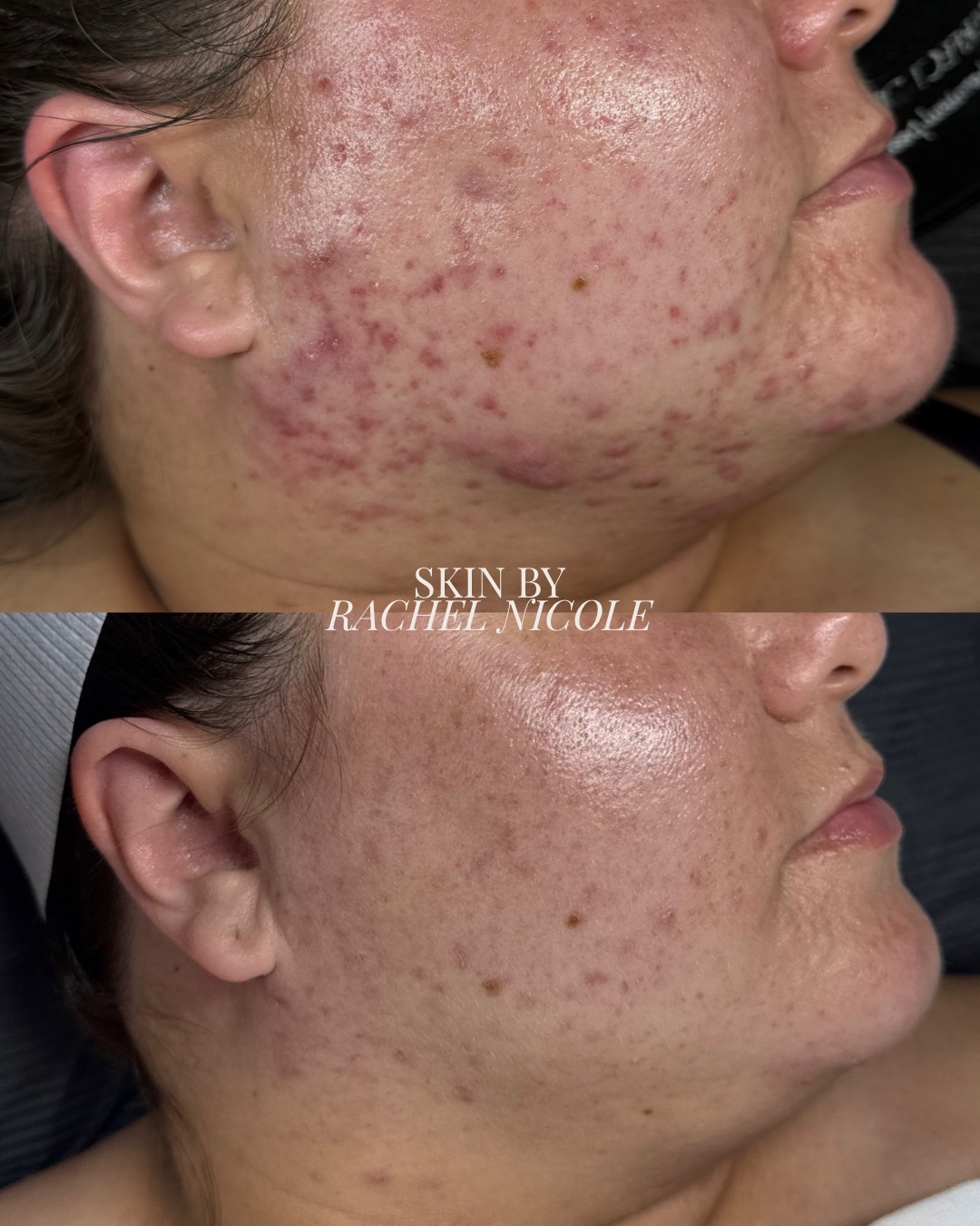 skin transformation