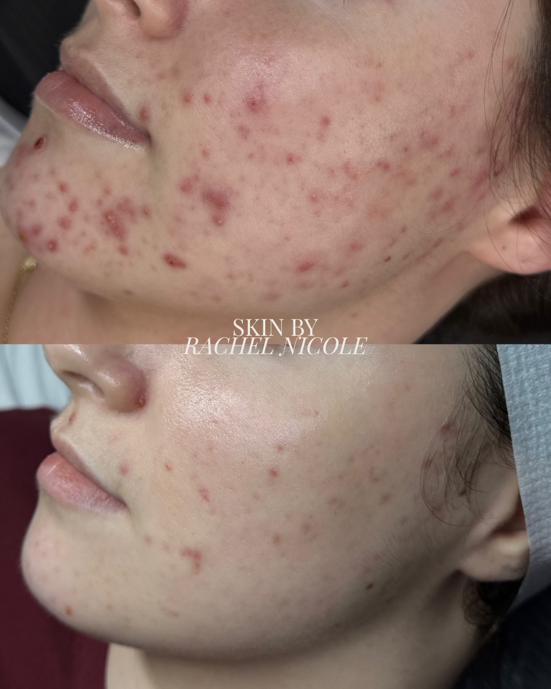 skin transformation