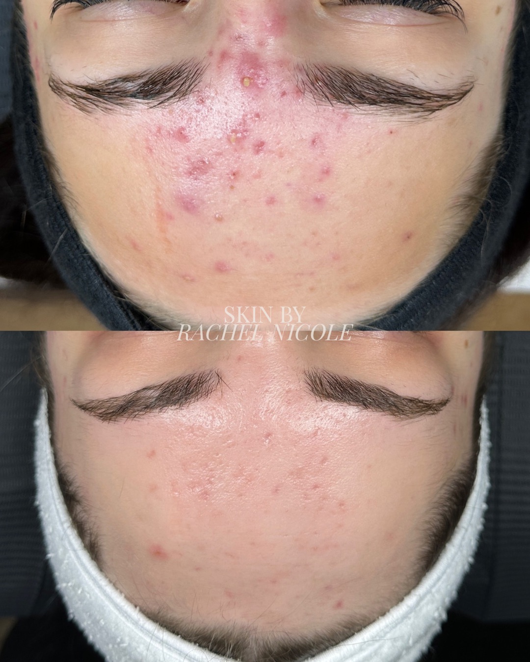 skin transformation