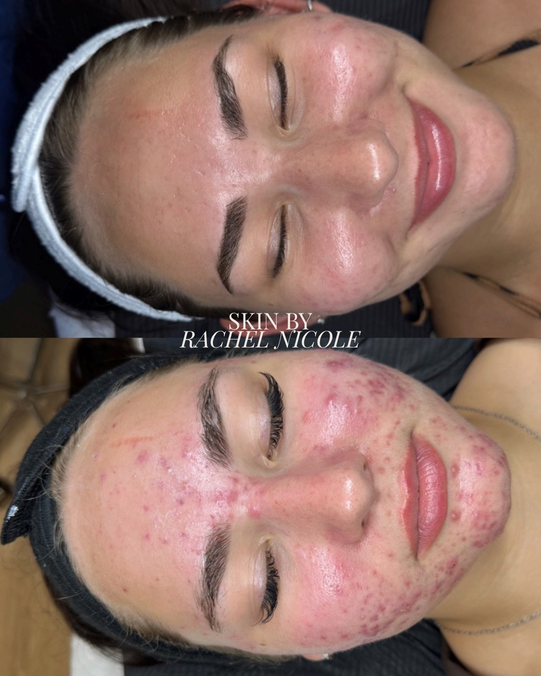 skin transformation